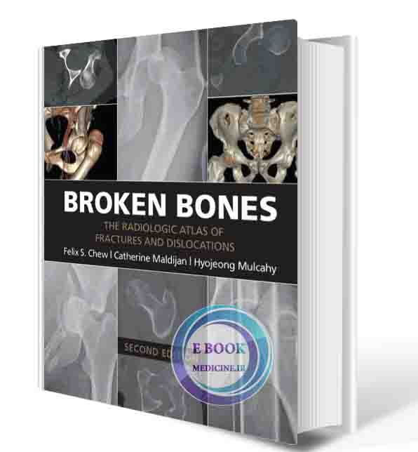 دانلود کتابBroken Bones: The Radiologic Atlas of Fractures and Dislocations 2nd (ORIGINAL PDF)